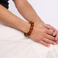 Chunky Bead Bracelet - Tortoiseshell
